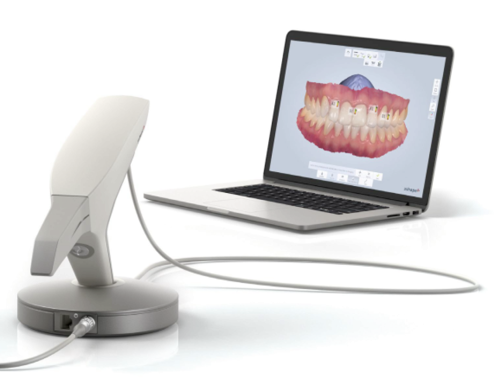 Scanner intraoral, diagnóstico digital, Dr. Rodrigo Sandin