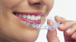 Invisalign x Aparelho Fixo: Como Decidir Qual é o Seu Caso