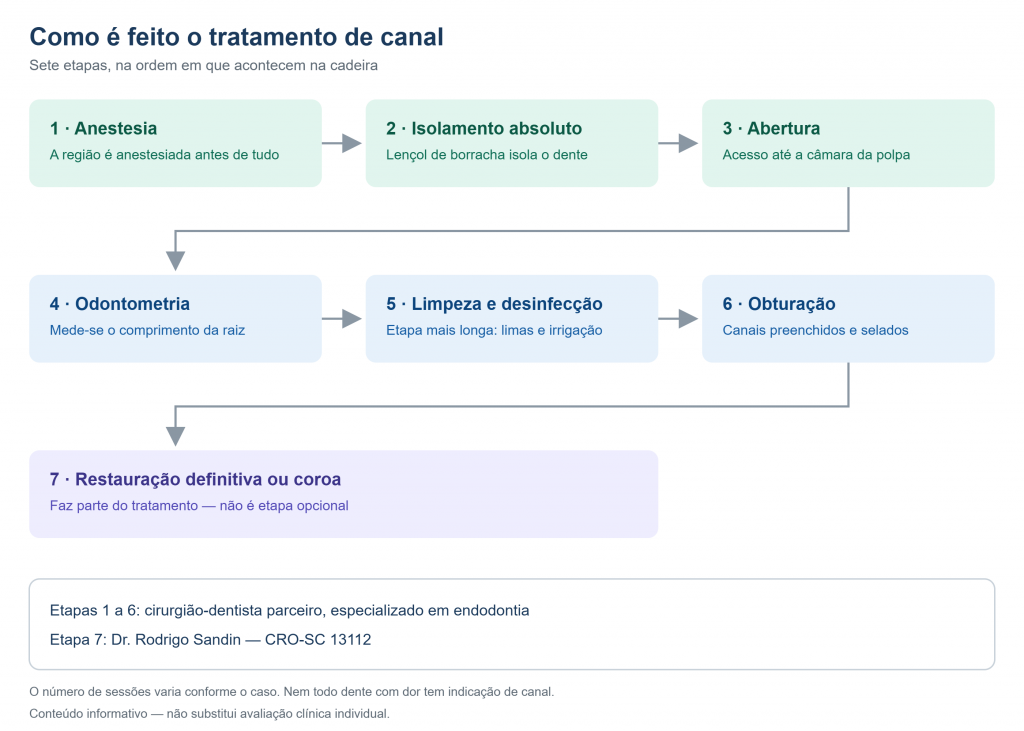 Diagrama das sete etapas do tratamento de canal, indicando que as etapas 1 a 6 são conduzidas por cirurgião-dentista parceiro especializado em endodontia e a etapa 7 pelo Dr. Rodrigo Sandin